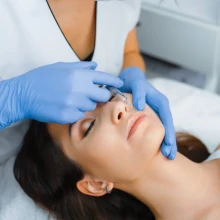 Botox e Preenchimento